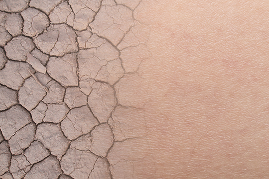 Dry skin texture condition