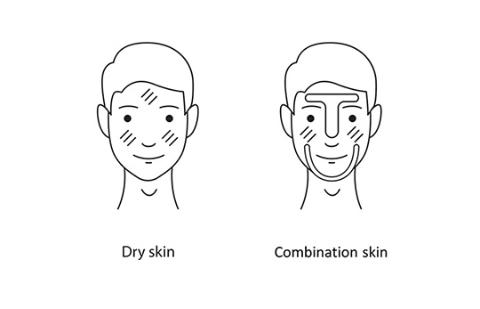 Dry skin Combination skin comparison